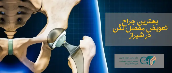 بهترین جراح تعویض مفصل لگن در شیراز
